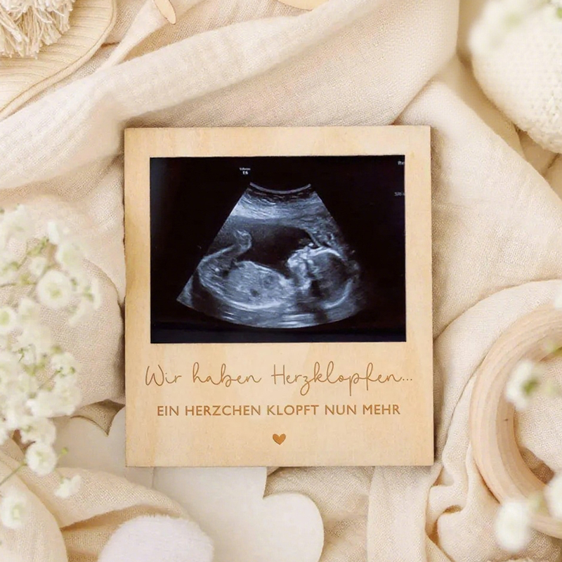 Ultrasound Pregnancy Announcem - مراجعة Photo Booth Frame وسعره