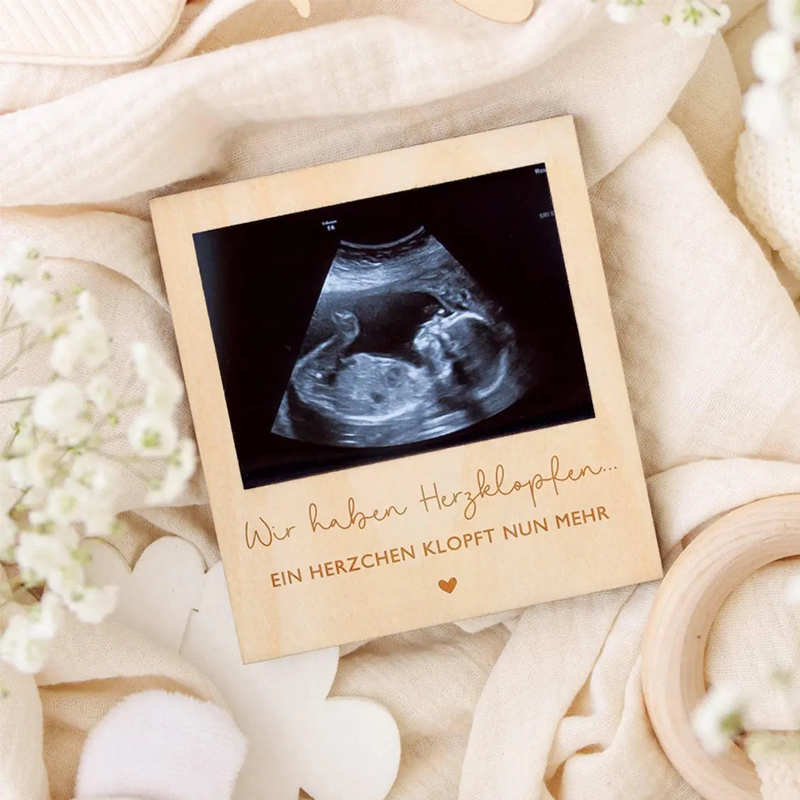 Ultrasound Pregnancy Announcem - مراجعة Photo Booth Frame وسعره